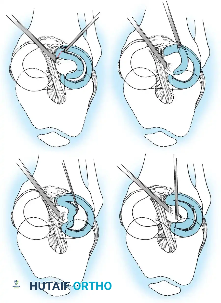 Arthroscopy of the Lower Extremity Surgical Diagram