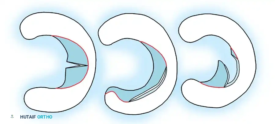 Arthroscopy of the Lower Extremity Surgical Diagram