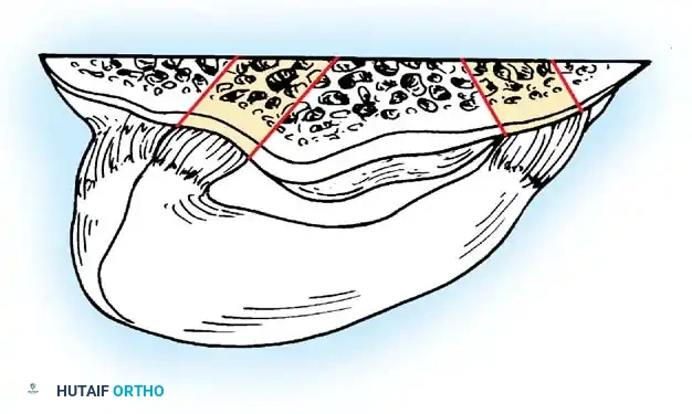 Arthroscopy of the Lower Extremity Surgical Diagram