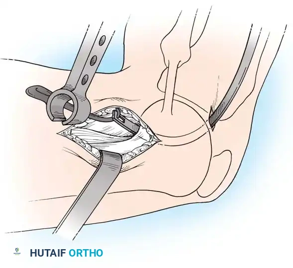 Arthroscopy of the Lower Extremity Surgical Diagram
