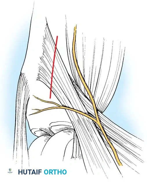 Arthroscopy of the Lower Extremity Surgical Diagram
