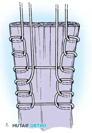 Arthroscopy of the Lower Extremity Surgical Diagram