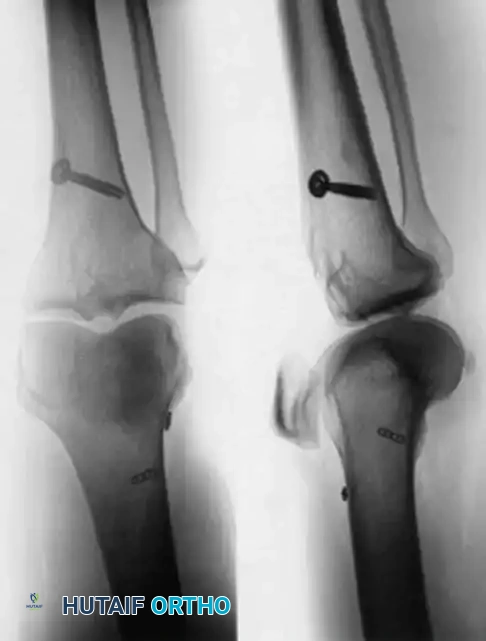 Arthroscopy of the Lower Extremity Surgical Diagram