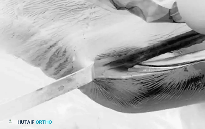 Arthroscopy of the Lower Extremity Surgical Diagram