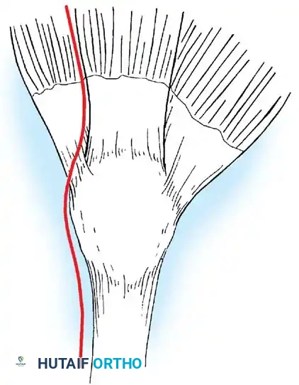 Vastus lateralis Vastus medialis