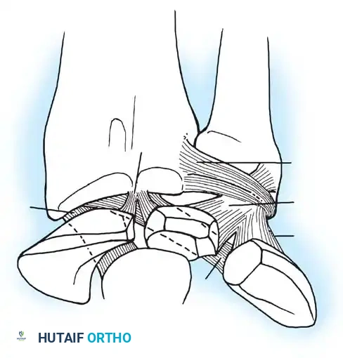 Mastering Wrist Arthroscopy: A Comprehensive Surgical Guide