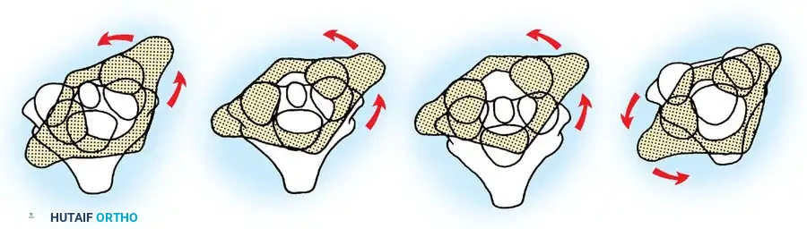 ATLANTOAXIAL ROTATORY SUBLUXATION Surgical Diagram