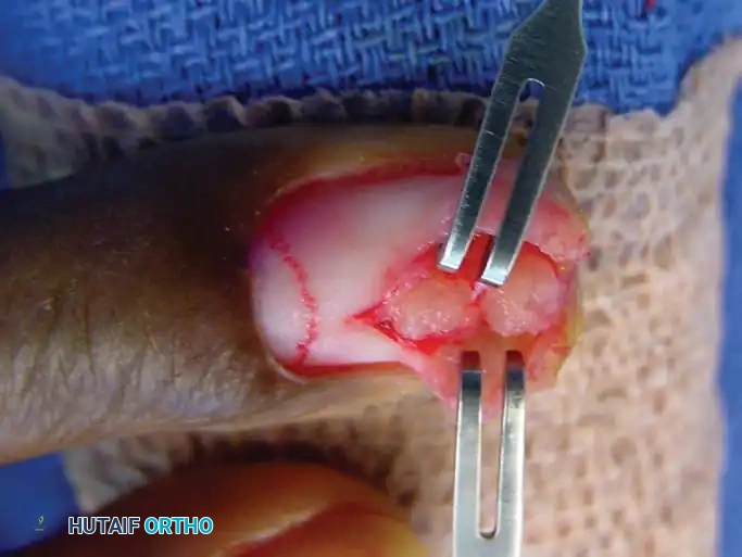 Hutaifortho's Orthopaedic Diagram