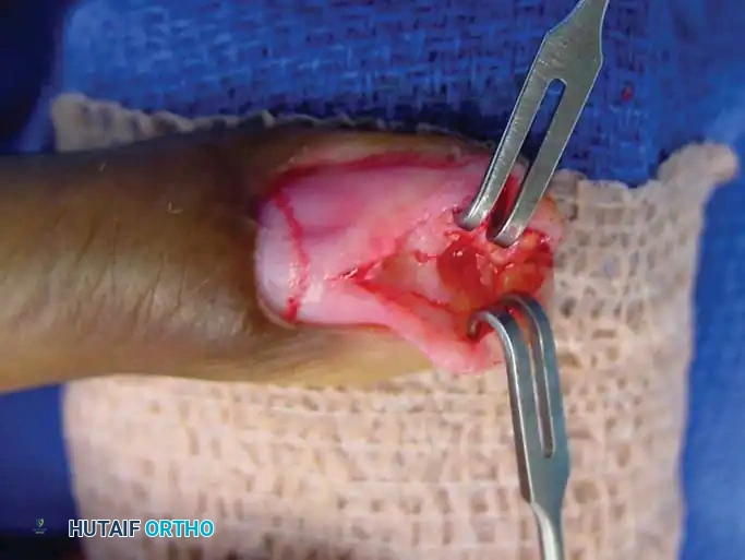 Hutaifortho's Orthopaedic Diagram