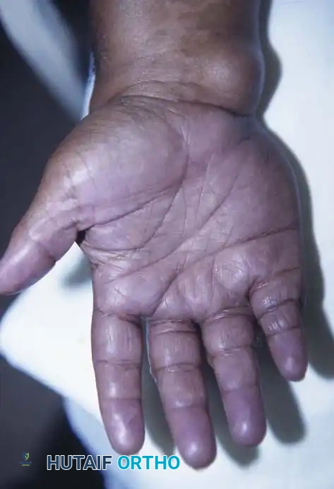 Hutaifortho's Orthopaedic Diagram