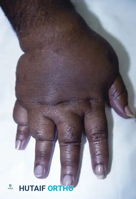 Hutaifortho's Orthopaedic Diagram