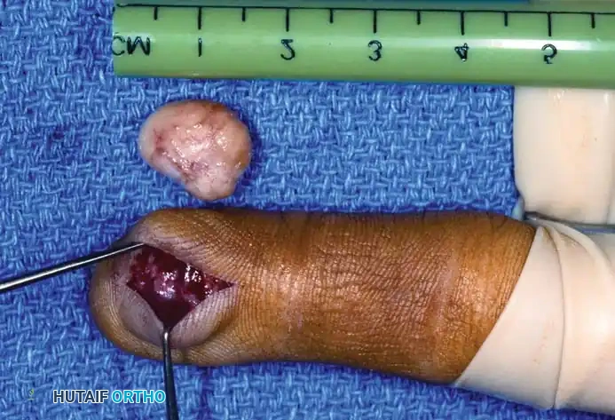 Hutaifortho's Orthopaedic Diagram