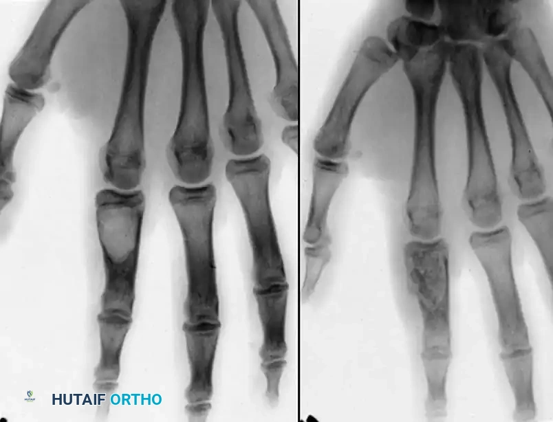 Hutaifortho's Orthopaedic Diagram