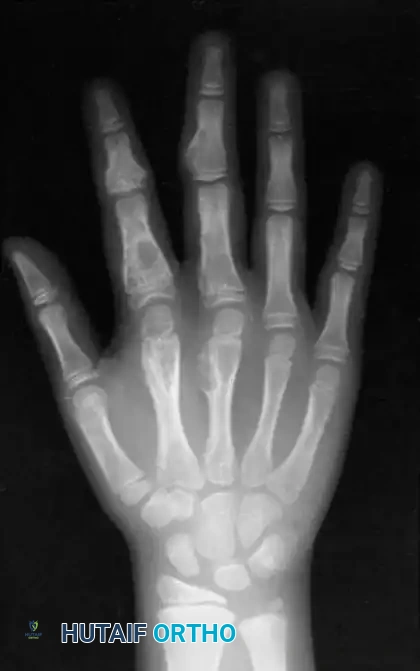 Hutaifortho's Orthopaedic Diagram