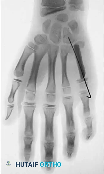 Hutaifortho's Orthopaedic Diagram