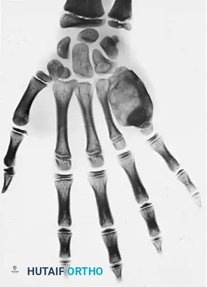 Hutaifortho's Orthopaedic Diagram