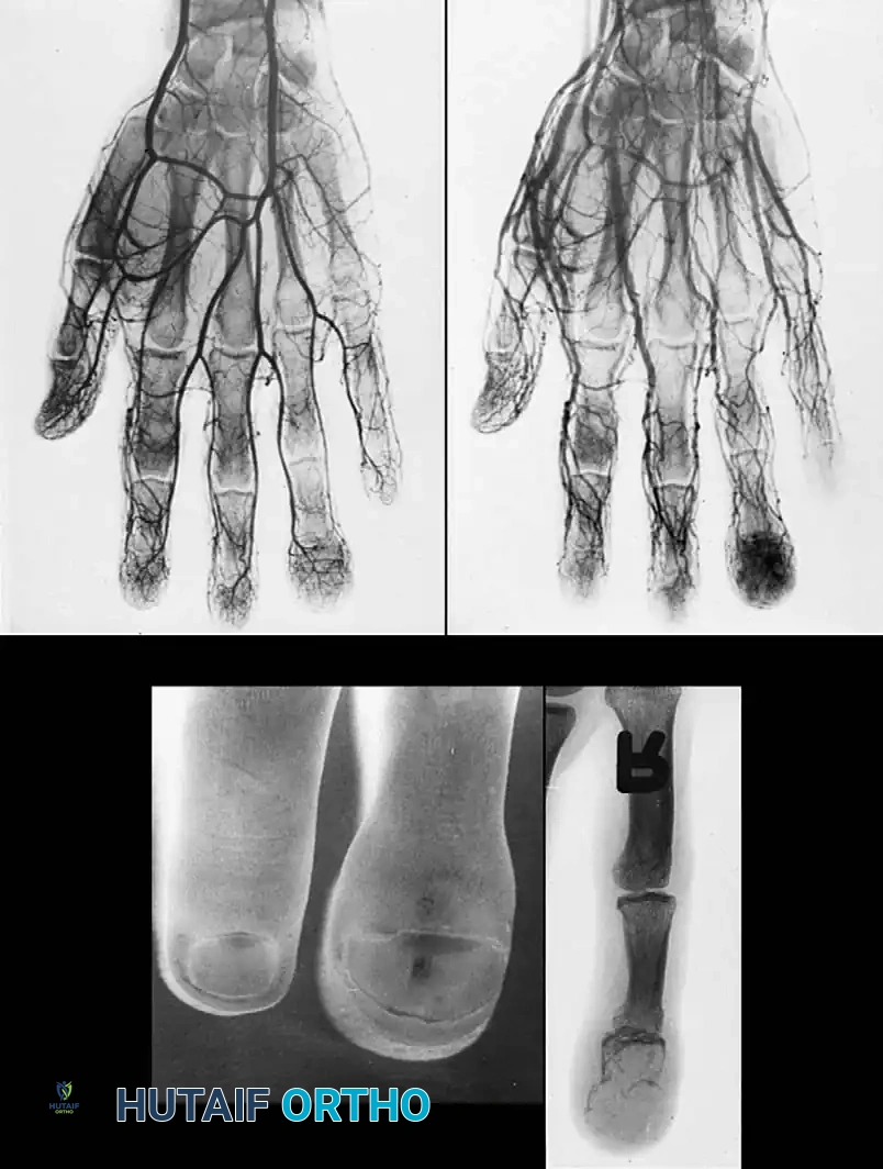 Hutaifortho's Orthopaedic Diagram