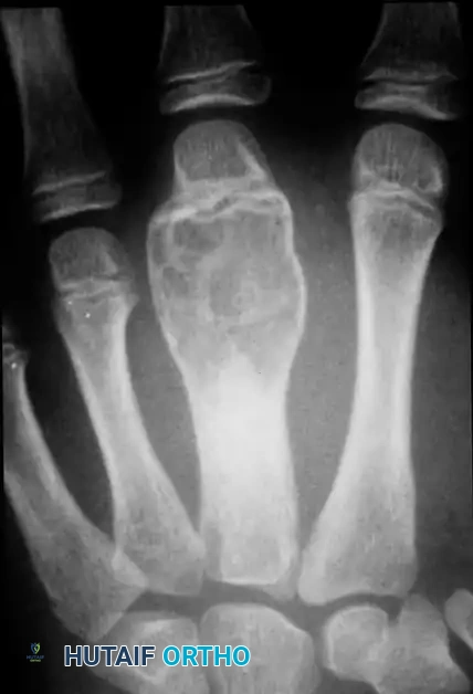 Hutaifortho's Orthopaedic Diagram