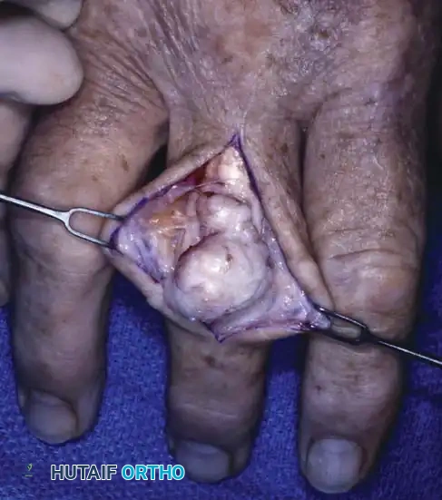 Hutaifortho's Orthopaedic Diagram