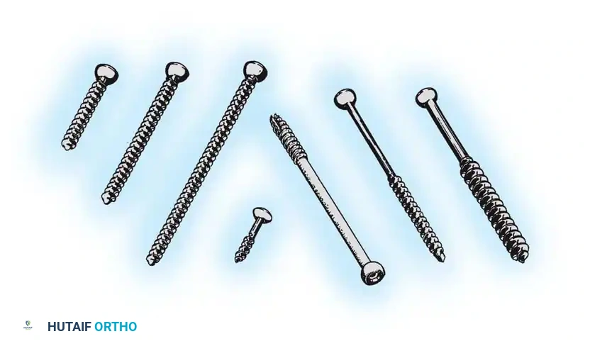 Fig. 50-21 Examples of cancellous and cortical screws for fracture fi xation.