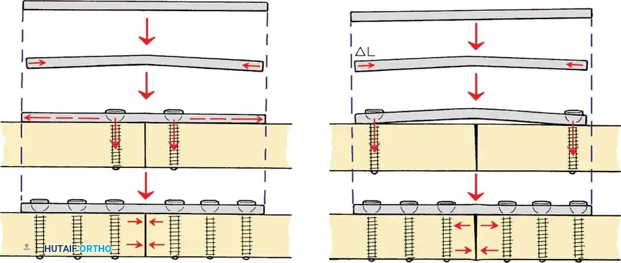 Hutaifortho's Orthopaedic Diagram