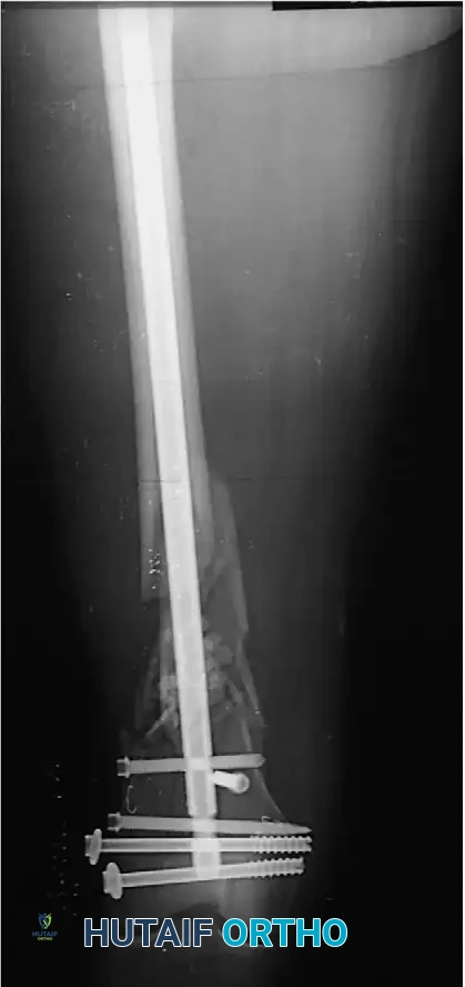 Hutaifortho's Orthopaedic Diagram