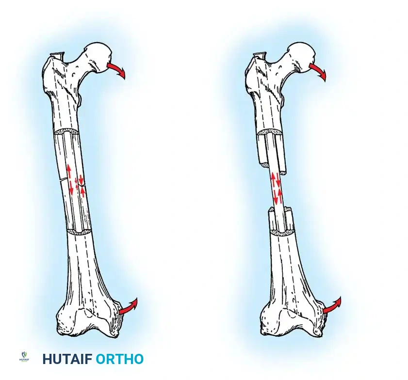 Hutaifortho's Orthopaedic Diagram
