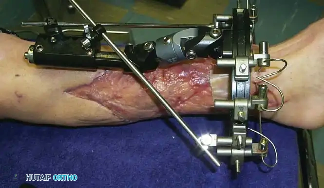 Hutaifortho's Orthopaedic Diagram