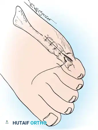 Hutaifortho's Orthopaedic Diagram