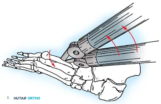 Hutaifortho's Orthopaedic Diagram