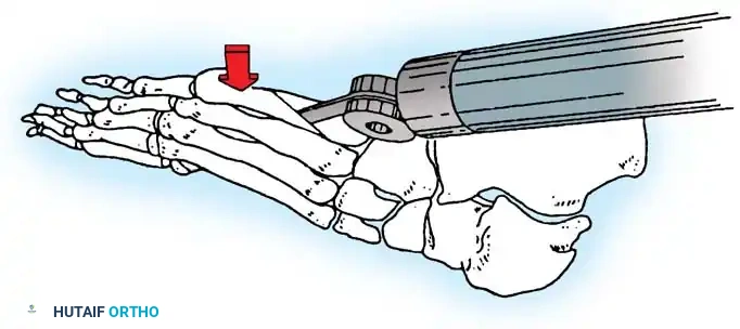 Hutaifortho's Orthopaedic Diagram