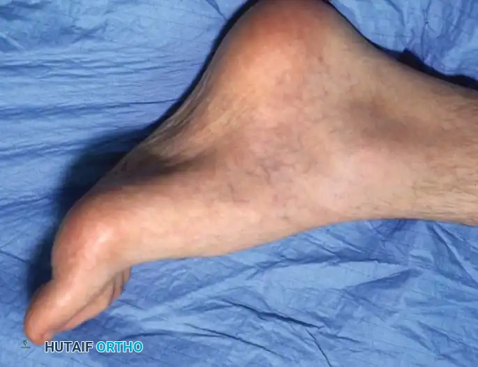 Hutaifortho's Orthopaedic Diagram