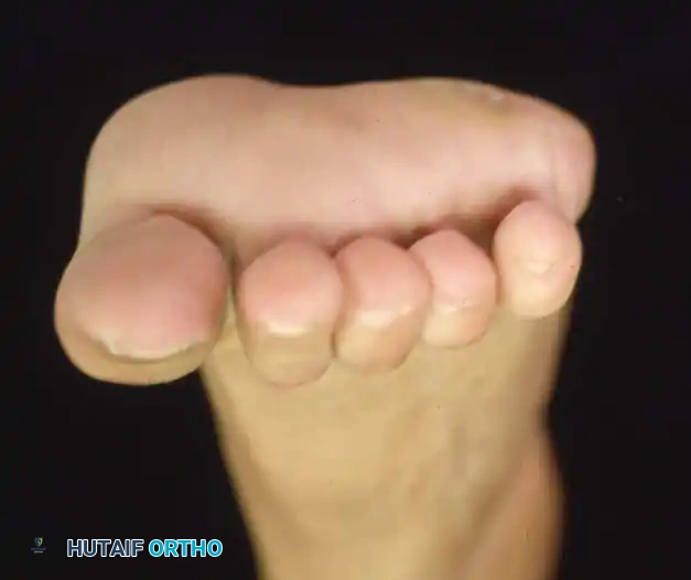 Hutaifortho's Orthopaedic Diagram