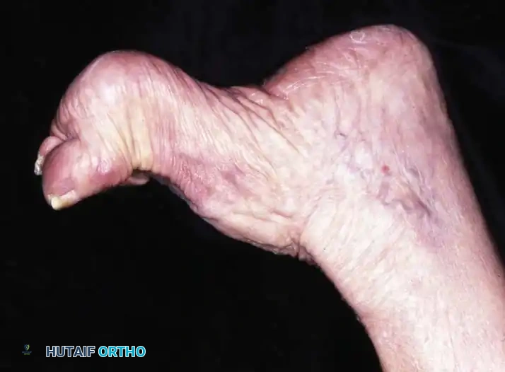 Hutaifortho's Orthopaedic Diagram