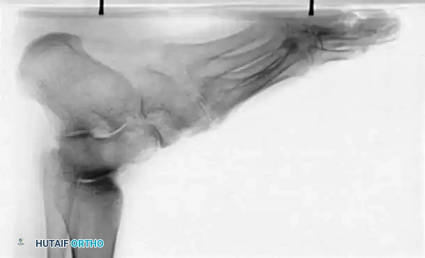 Hutaifortho's Orthopaedic Diagram