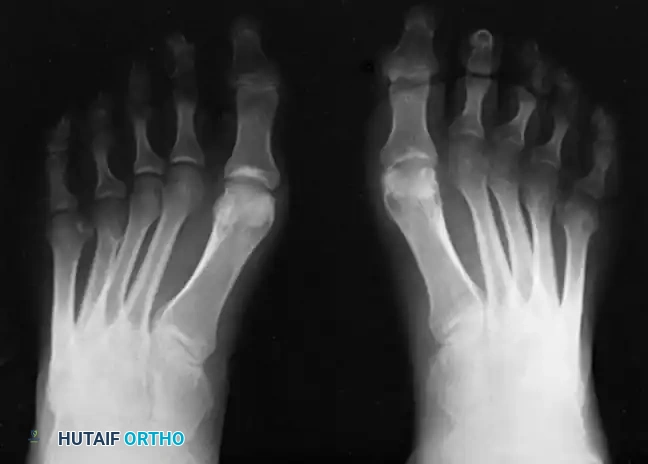 Hutaifortho's Orthopaedic Diagram