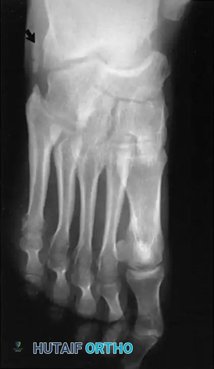 Hutaifortho's Orthopaedic Diagram