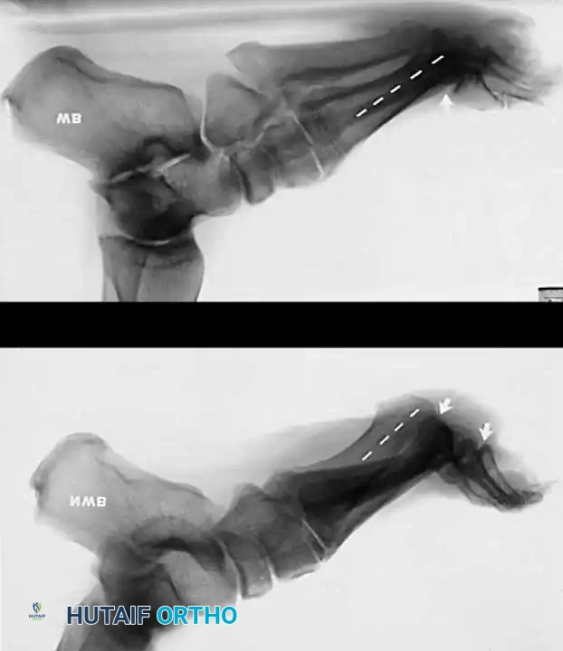 Hutaifortho's Orthopaedic Diagram