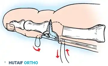 Hutaifortho's Orthopaedic Diagram