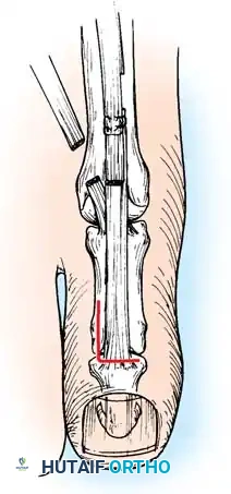 Hutaifortho's Orthopaedic Diagram