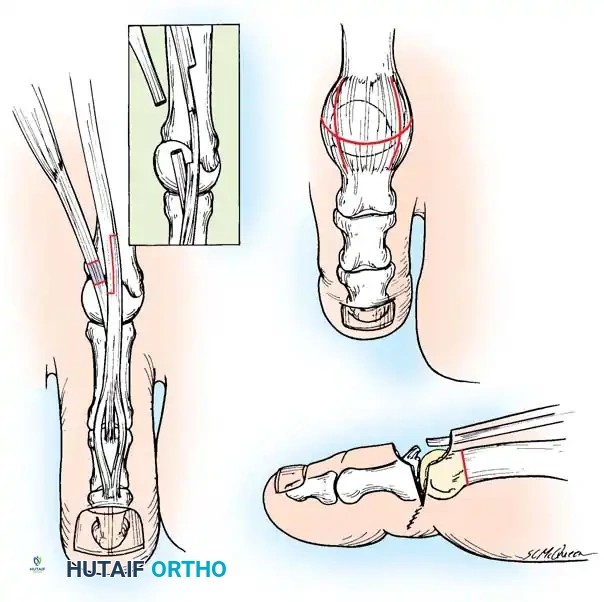 Hutaifortho's Orthopaedic Diagram