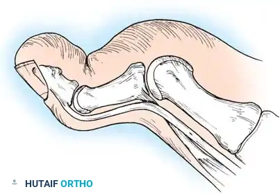 Hutaifortho's Orthopaedic Diagram