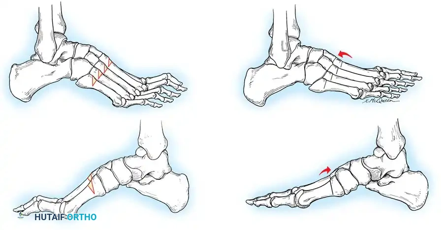 Hutaifortho's Orthopaedic Diagram