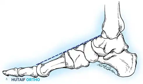 Hutaifortho's Orthopaedic Diagram