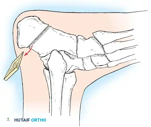 Hutaifortho's Orthopaedic Diagram
