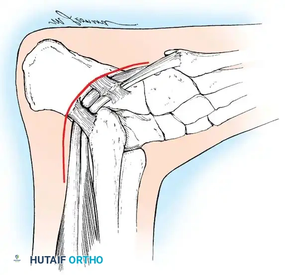 Hutaifortho's Orthopaedic Diagram