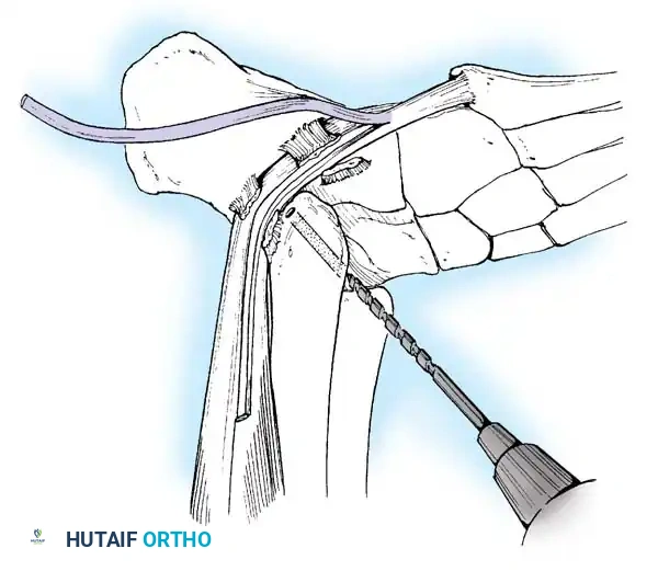 Hutaifortho's Orthopaedic Diagram