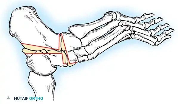 Hutaifortho's Orthopaedic Diagram