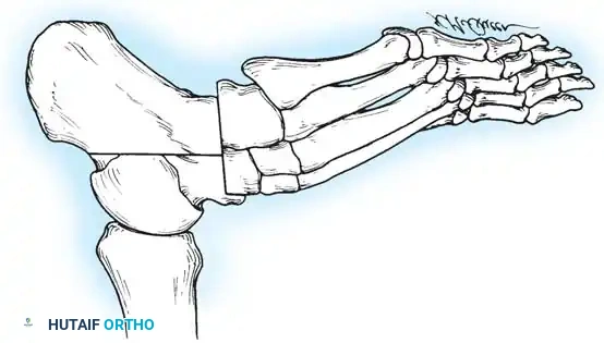 Hutaifortho's Orthopaedic Diagram