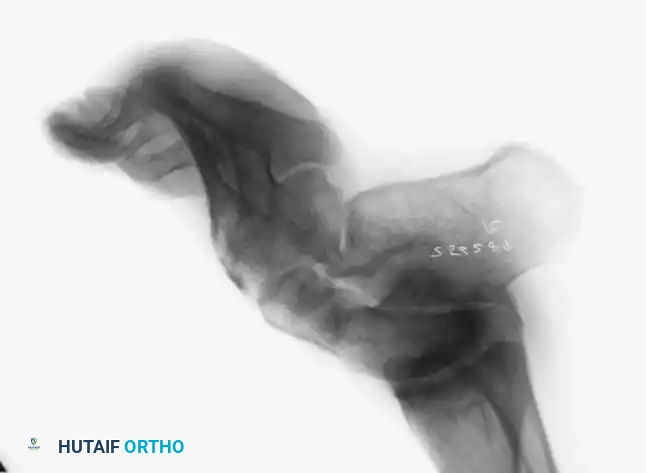 Hutaifortho's Orthopaedic Diagram